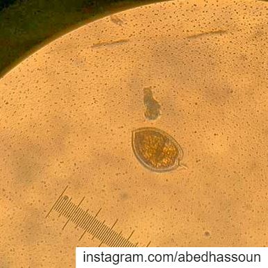 Beautiful phytoplankton species!............. phytoplankton ... (NCMS-National Center for Marine Sciences  / CNRS-Lebanon)